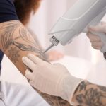 How Long Does Tattoo Removal Take